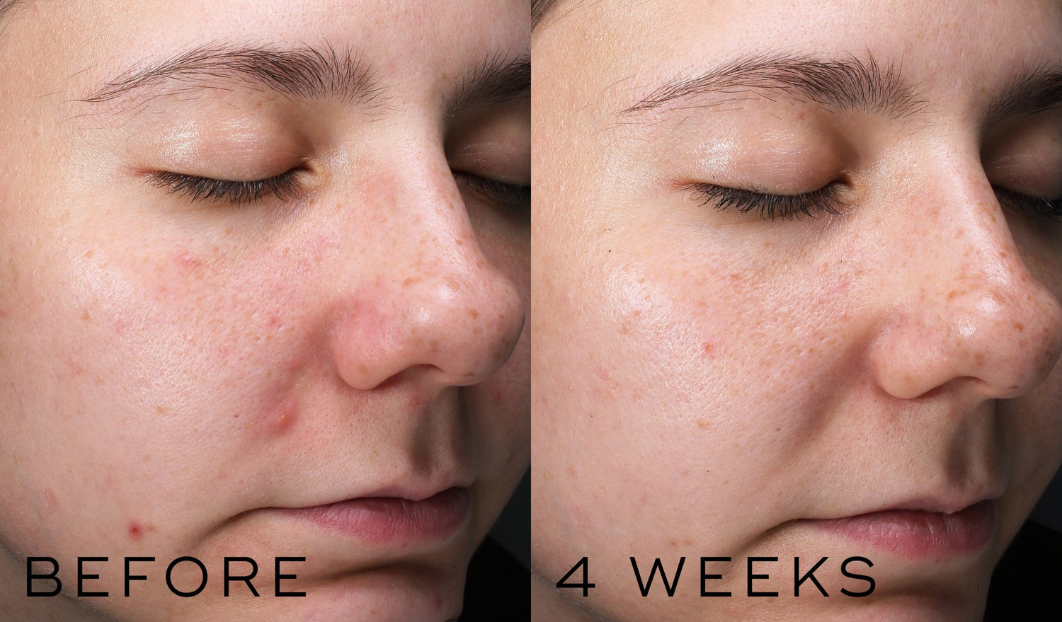 Clarity Peptides