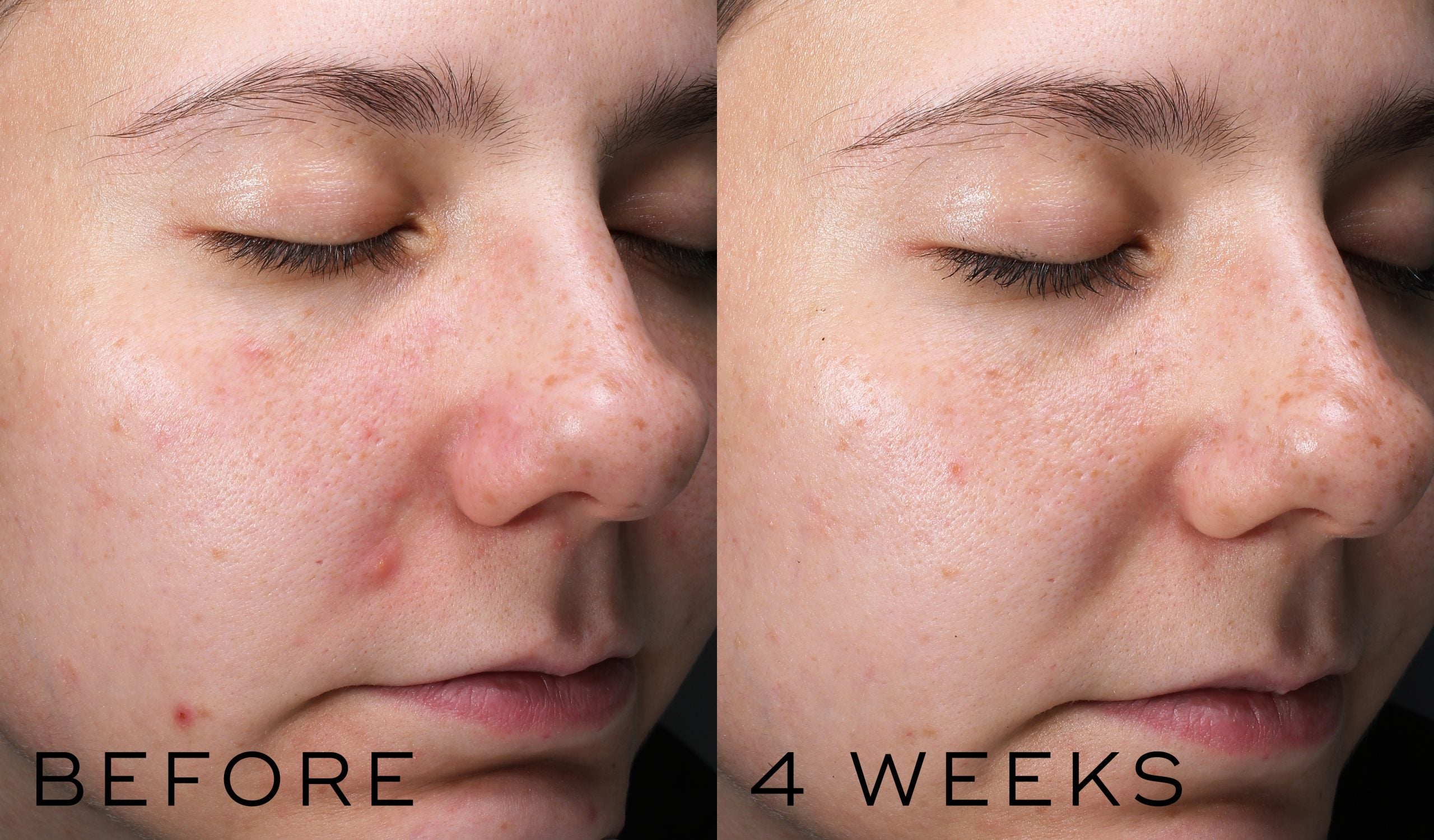 Clarity Peptides