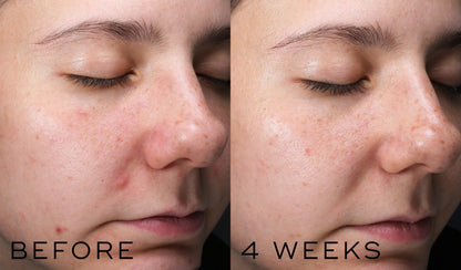 Clarity Peptides
