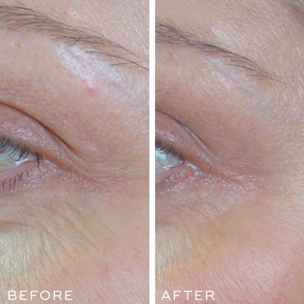 r-Retinoate Day &amp; Night EYE Serum